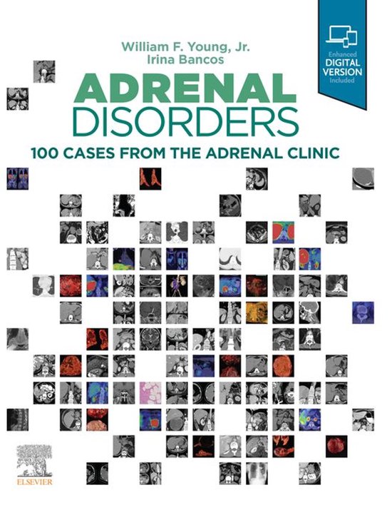 Adrenal Disorders,E-Book - cover