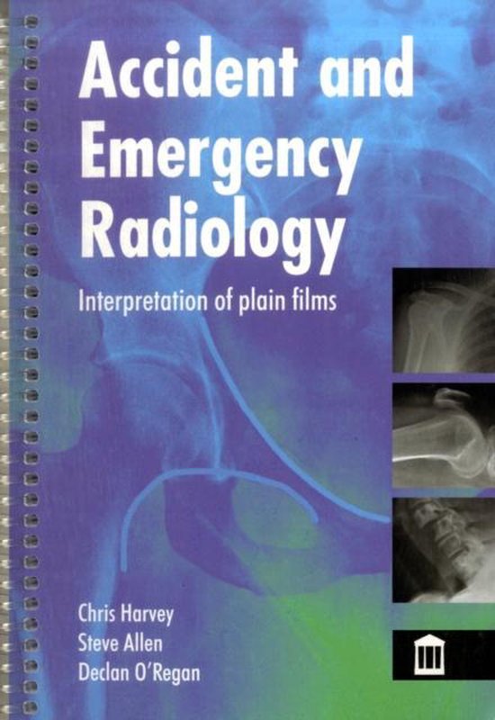 Accident and Emergency Radiology 9781856423151 Christopher Harvey