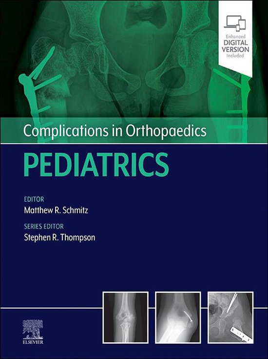 Complications in Orthopaedics - Complications in Orthopaedic ... - cover