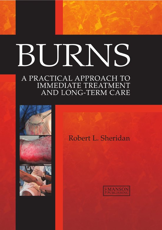 Burns - cover