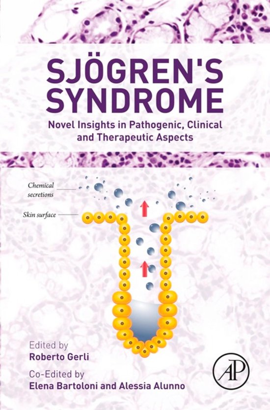 Sjogren's Syndrome - cover