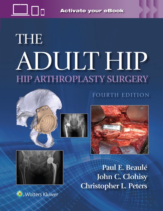 The Adult Hip: Hip Arthroplasty Surgery Print + eBook with M ... - cover