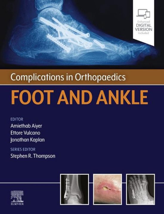 Complications in Orthopaedics - Complications in Orthopaedic ... - cover