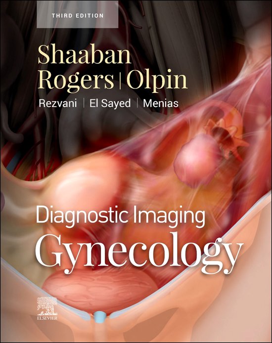 Diagnostic Imaging Diagnostic Imaging Gynecology (ebook), Akram M