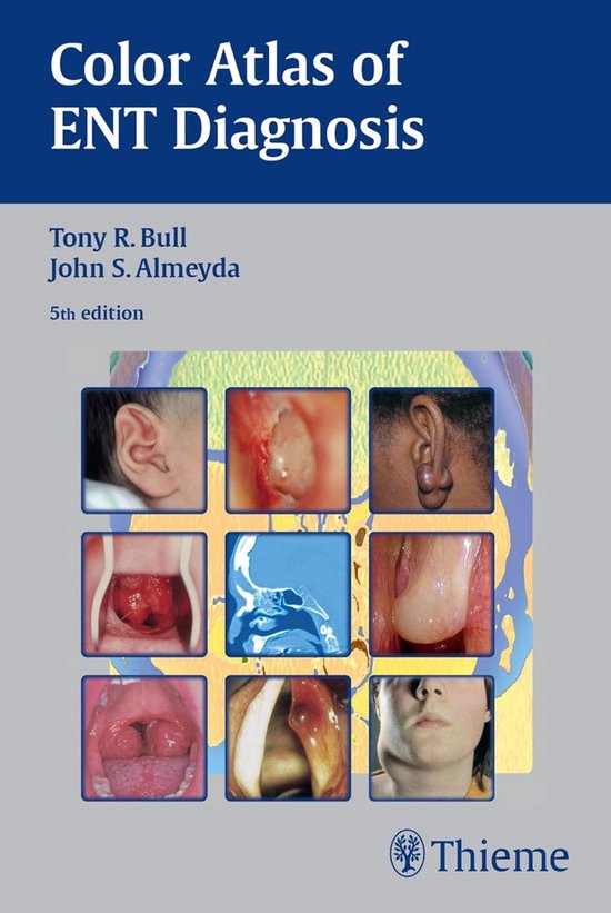 Color Atlas of ENT Diagnosis (ebook), John S. Almeyda | 9783132579330 ...