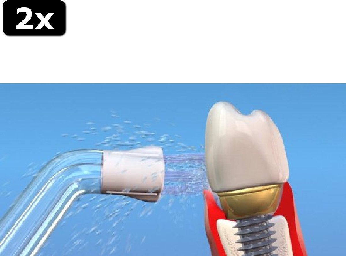 2x Waterpik PS-100E Plaque Seeker Tips - Opzetstukken Voor Waterflossers - 2 Stuks - zilver