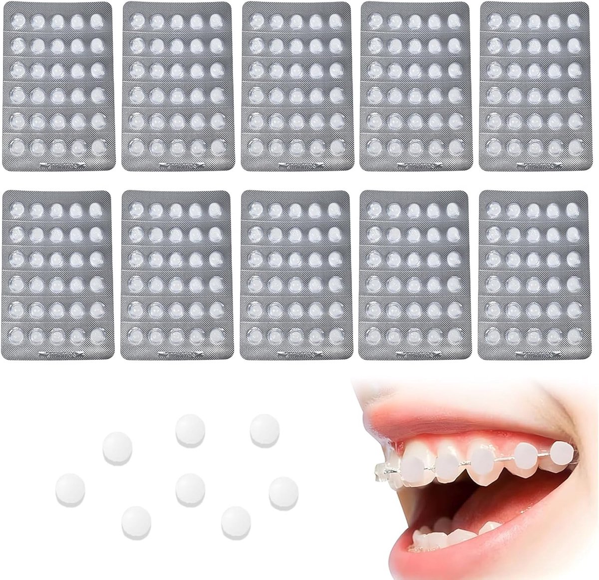 Orthodontische was 300 stuks - afzonderlijk verpakt - hygiënisch - voorkomt krassen in de mond - ShopVlot