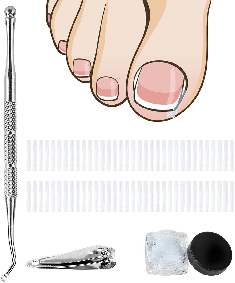 Dailygoods- Teennagelcorrectie - Gereedschapsset - Teennagelpatch - Corrector - Pedicuregereedschap - Effectieve behandeling - Teennagelcorrector