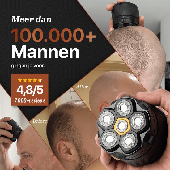 De Skull Master met 6 flexibele scheerkoppen, met tekst "Meer dan 100.000 Mannen gingen je voor." en "4,8/5 7.000+ reviews".