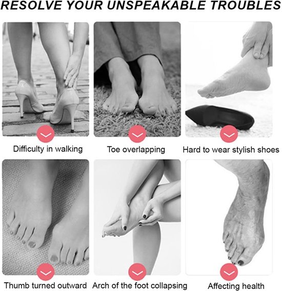 Hallux Valgus Orthese - 3-delige Teenz separator voor mannen en vrouwen, bescherming tegen overlappende tenen, bunion corrector en voetuitlijning — afbeelding 3