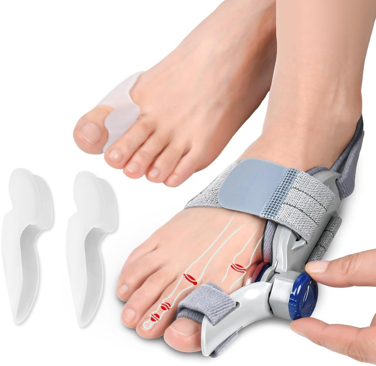 Corrigerende rail voor hallux valgus - Effectieve behandeling voor bunions, voetcorrectie en pijnverlichting