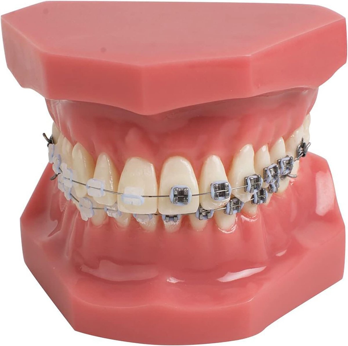 Tanden Model - Orthodontisch Model - Tandheelkundig Onderwijs - Met Beugels - Niet Gespecificeerd - Rood