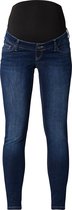 Queen Mum Broek - Dark Wash - Maat 26