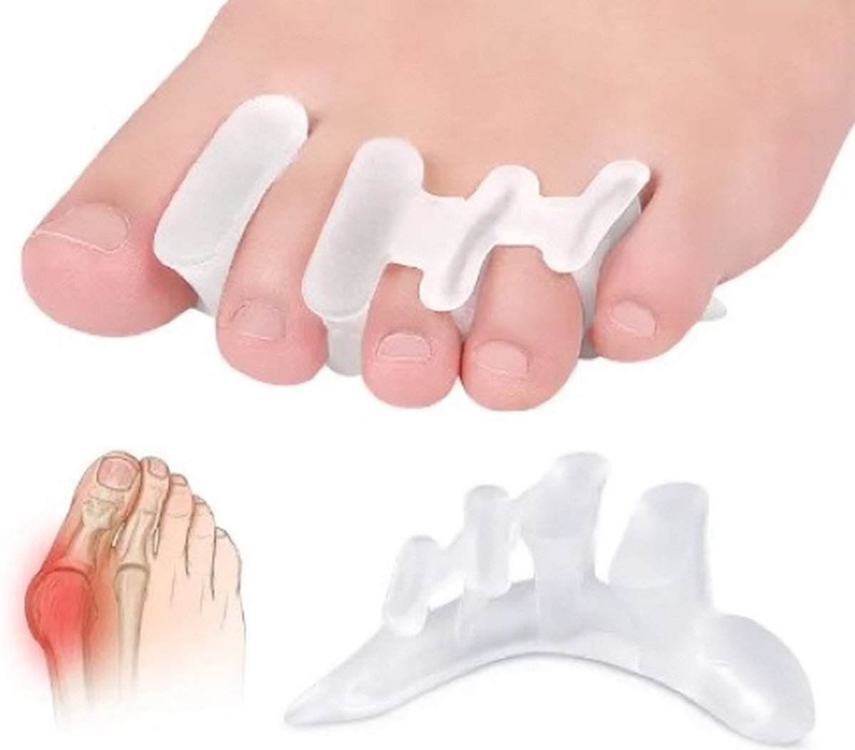 Goedkoopste Teenspreider - Hallux Valgus - teencorrector - grote en kleine teen separator - voor alle tenen 2 stuks