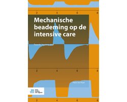 Mechanische beademing op de intensive care