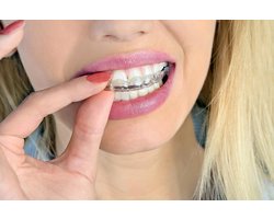 Grehge oth, Bite and Dentures – Breathable Case with Vent Holes – Portable, Durable and Easy to Clean – 75 x 60 x 35 - ShopVlot
