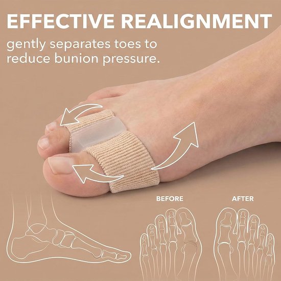 4 stuks siliconen teenslippers - afstandhouders voor hallux valgus - eenheidsmaat voor dames en heren — afbeelding 3