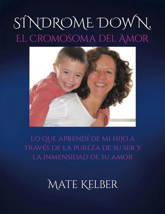 SÍNDROME DOWN El Cromosoma del Amor - cover