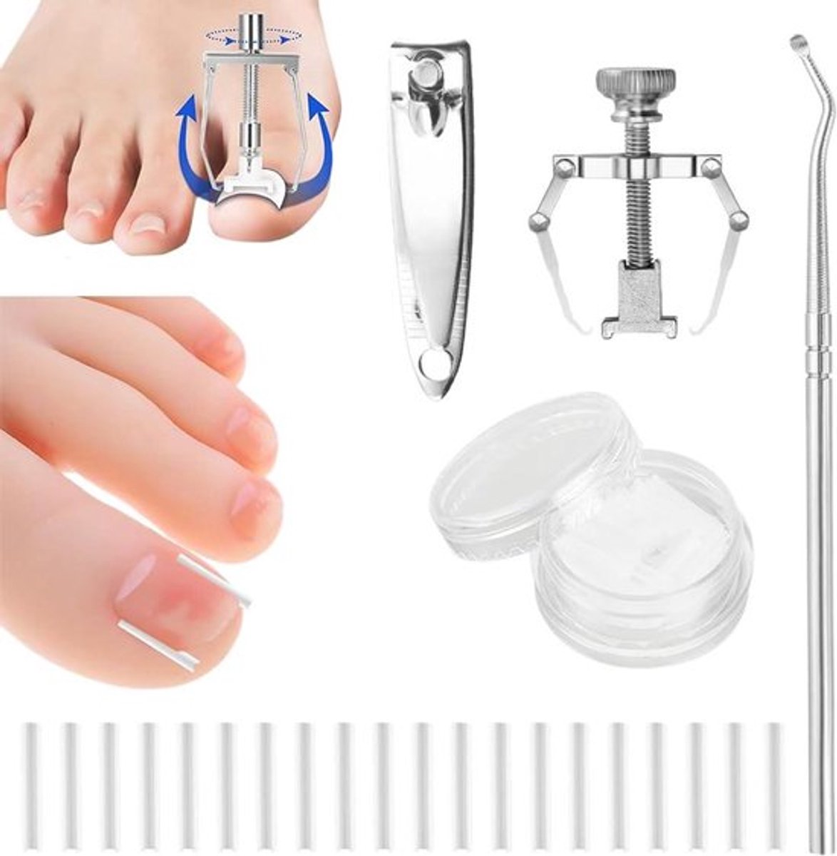 Behandelingsset voor ingegroeide teennagels en teennagellifting - 50 stuks