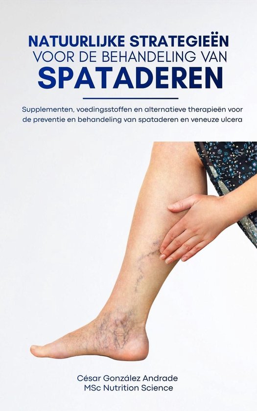 Natuurlijke strategieën voor de behandeling van spataderen - cover