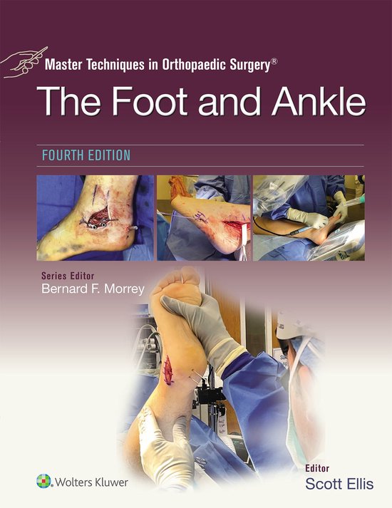 Master Techniques in Orthopaedic Surgery: The Foot and Ankle - cover