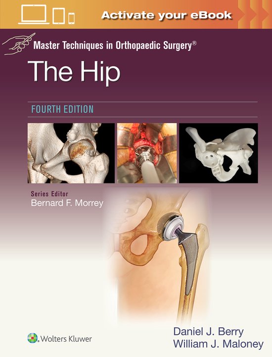 Master Techniques in Orthopaedic Surgery: The Hip: Print + e ... - cover