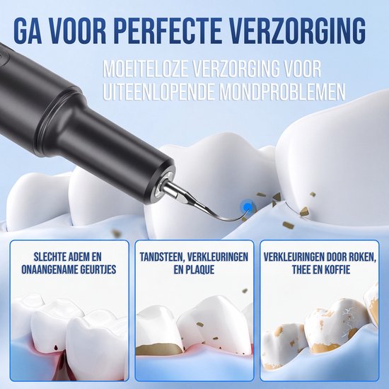 Elektrische tandsteenverwijderaar verwijdert tandsteen, tandplak en vlekken door roken/thee/koffie van tanden.