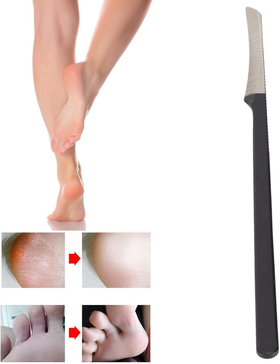 Pedicureschraper roestvrij staal - dode huid verwijderder - ergonomisch ontwerp - voor zachte voeten - ShopVlot