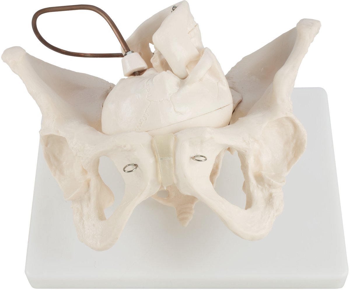 Anatomisch model van een vrouwelijk skelet met een geboortedemonstratie, bekkenmodel, anatomisch lesmodel van een vrouwelijk bekken, MedMod