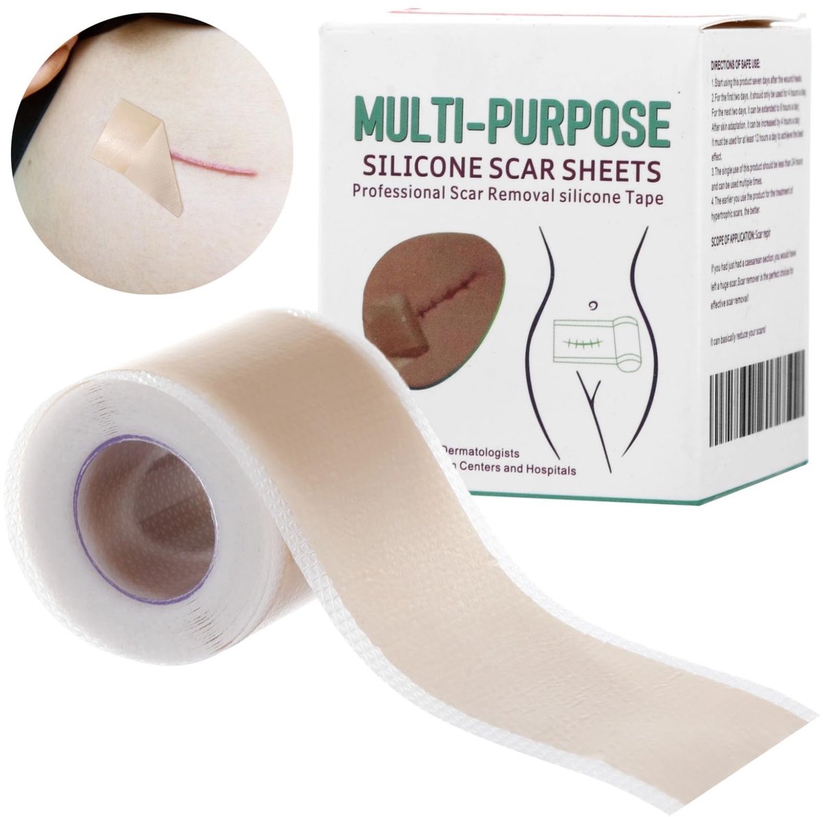 Solidchoice - Herbruikbare Siliconen Littekenpleisters (4 x 300 cm)