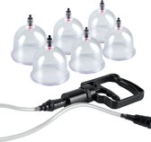 Beginners Cupping Set - 6 Delig