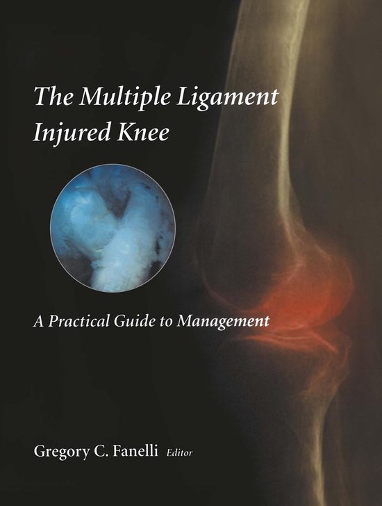 Medicine (R0) - The Multiple Ligament Injured Knee - cover