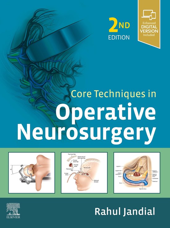 Core Techniques in Operative Neurosurgery E-Book - cover