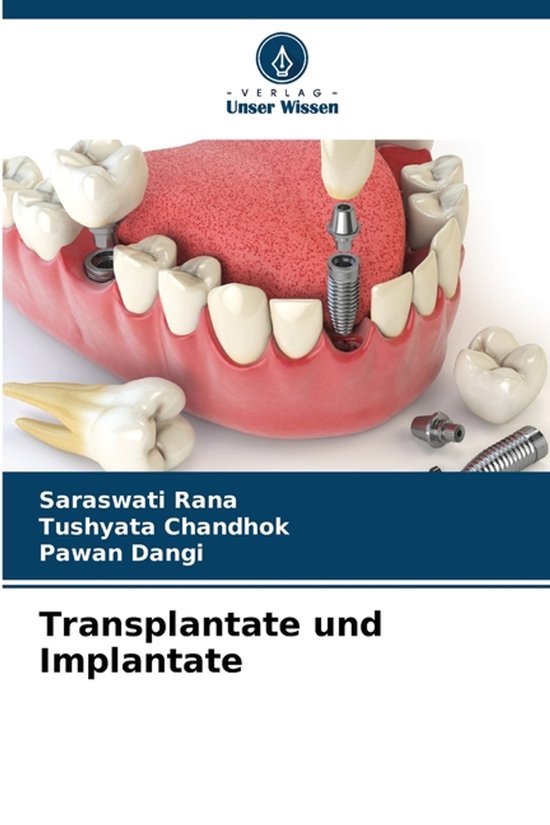 Een boek met de titel 'Transplantate und Implantate'. De cover toont een tandheelkundige illustratie van tanden en implantaten.