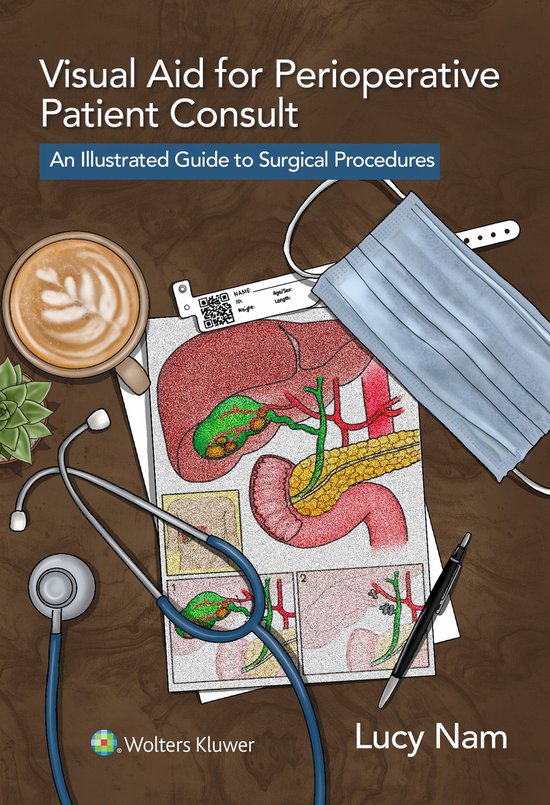 Visual Aid for Perioperative Patient Consult - cover
