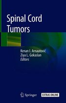 Spinal Cord Tumors