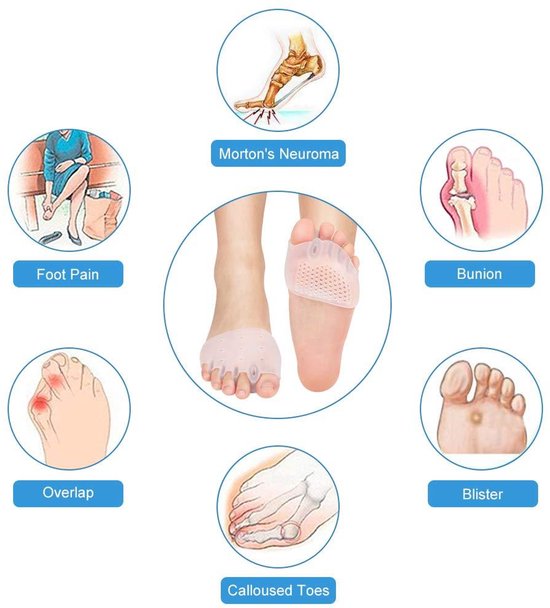 Orthopedische sandalen voor heren, sandalen voor eeltknobbels, grote teen- voetcorrectiesandaal, voor pijnverlichting Hallux valgus Bunion-symptomen ( Color : Bronze, Size : 38 EU Orthopedische sandalen voor heren, sandalen voor eeltknobbels, grote teen- voetcorrectiesandaal, voor pijnverlichting Hallux valgus Bunion-symptomen ( Color : Bronze, Size : 38 EU