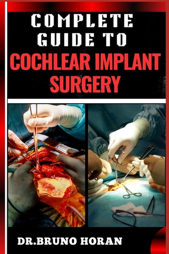 Complete Guide to Cochlear Implant Surgery - cover