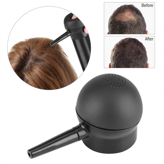 1 stuk haarvezel applicator, zwarte haarvezel spuitmond, haarverdikkingstool voor het verdikken van dunner wordend of kaal wordend haar 10,5 x 5,5 cm — afbeelding 2