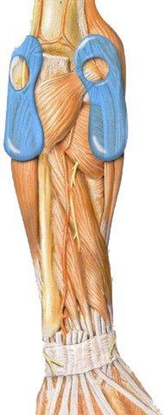 Bauerfeind Epitrain Elleboogbrace / Elleboogbandage-Maat 4: 25 - 27 cm