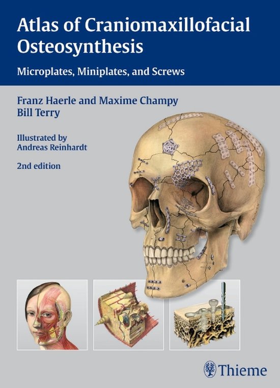 Atlas of Craniomaxillofacial Osteosynthesis - cover