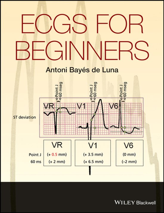 ECGs for Beginners - cover
