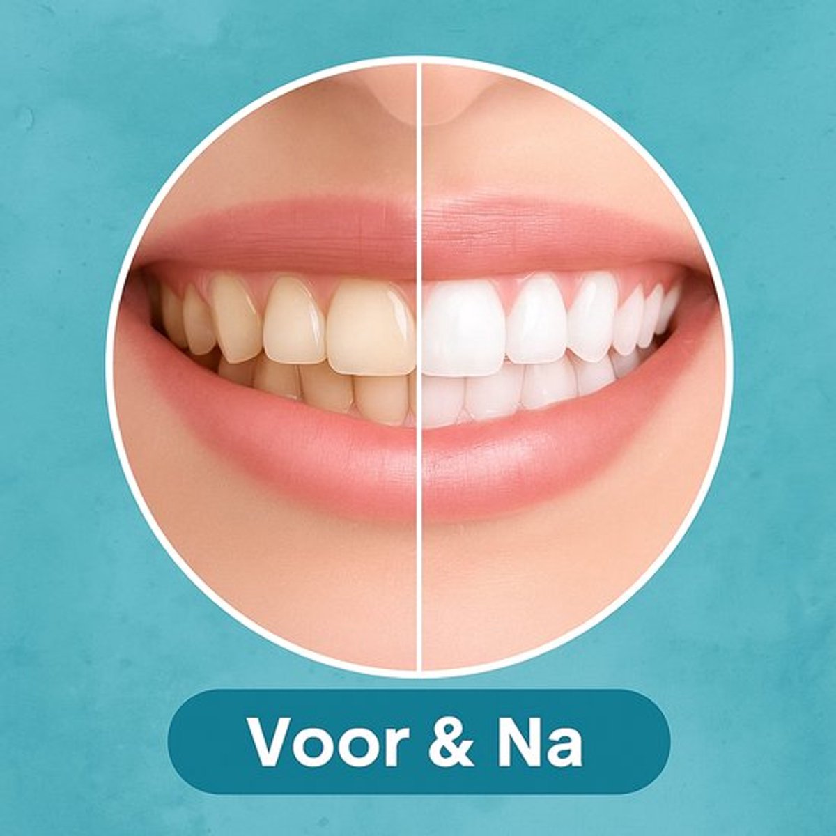 Smartbrush Elektrische Tandenborstel met Slimme Technologie - afbeelding 3