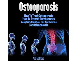 Osteoporosis: How To Treat Osteoporosis: How To Prevent Osteoporosis: Along With Nutrition, Diet And Exercise For Osteoporosis