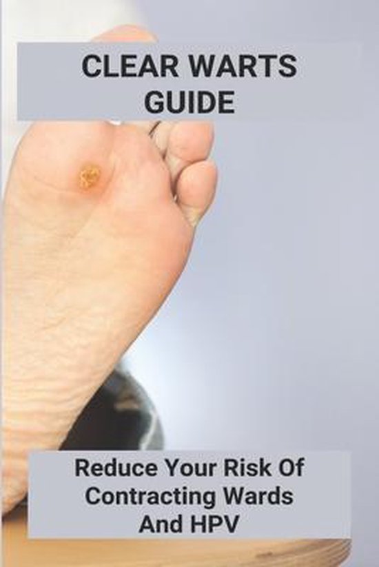 Clear Warts Guide - cover