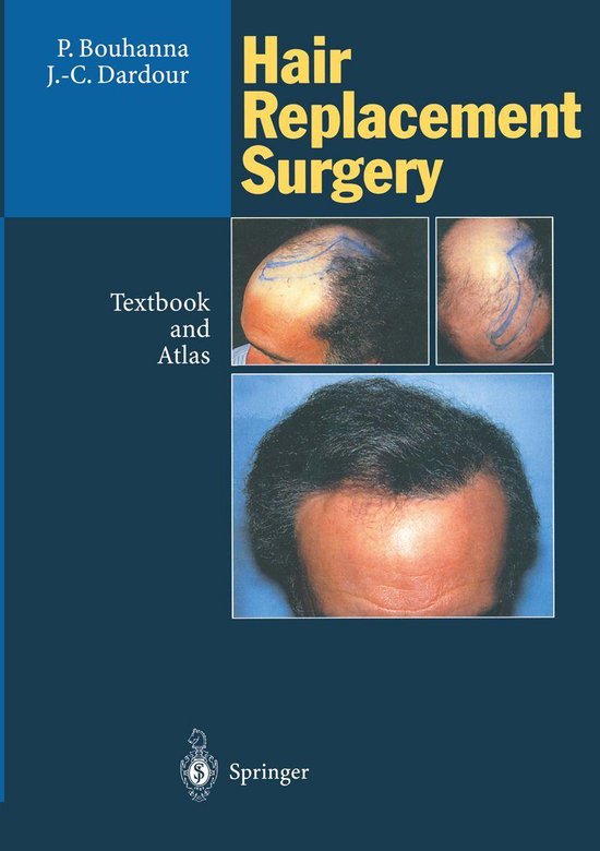 Medicine (R0) - Hair Replacement Surgery - cover