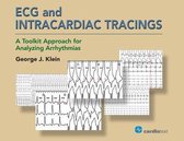 ECG and Intracardiac Tracings