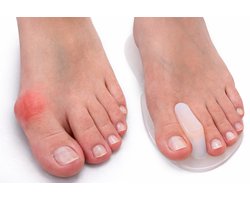 Uriel - Teenspreider - Hallux valgus - Voorvoetkussen - Gel - Drukverlichting - 1 paar