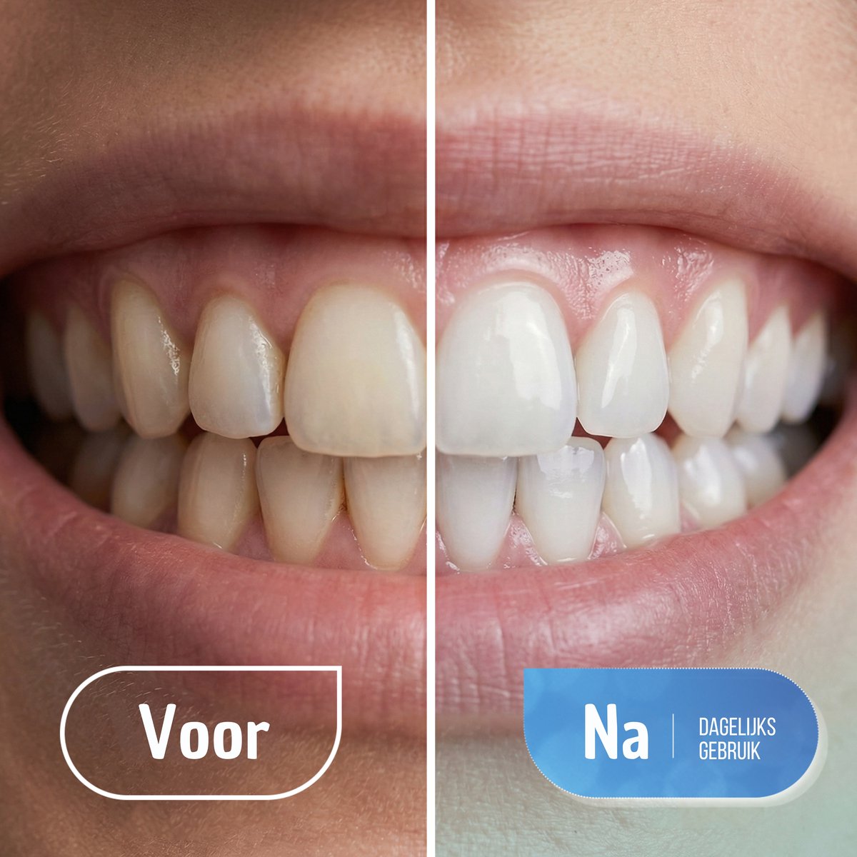 Flossing Floss Pro - Waterflosser thumbnail 4