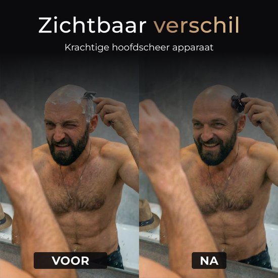 Wellshave 5 in 1 Scheerapparaat Mannen Deluxe - Gezicht en Hoofd Trimmer - Head Shaver - Elektrische Shaver